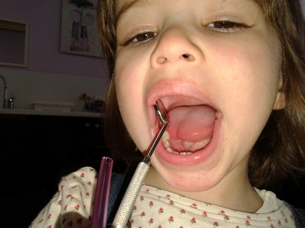 prvi pregled kod zubara