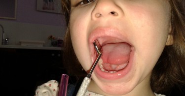 prvi pregled kod zubara